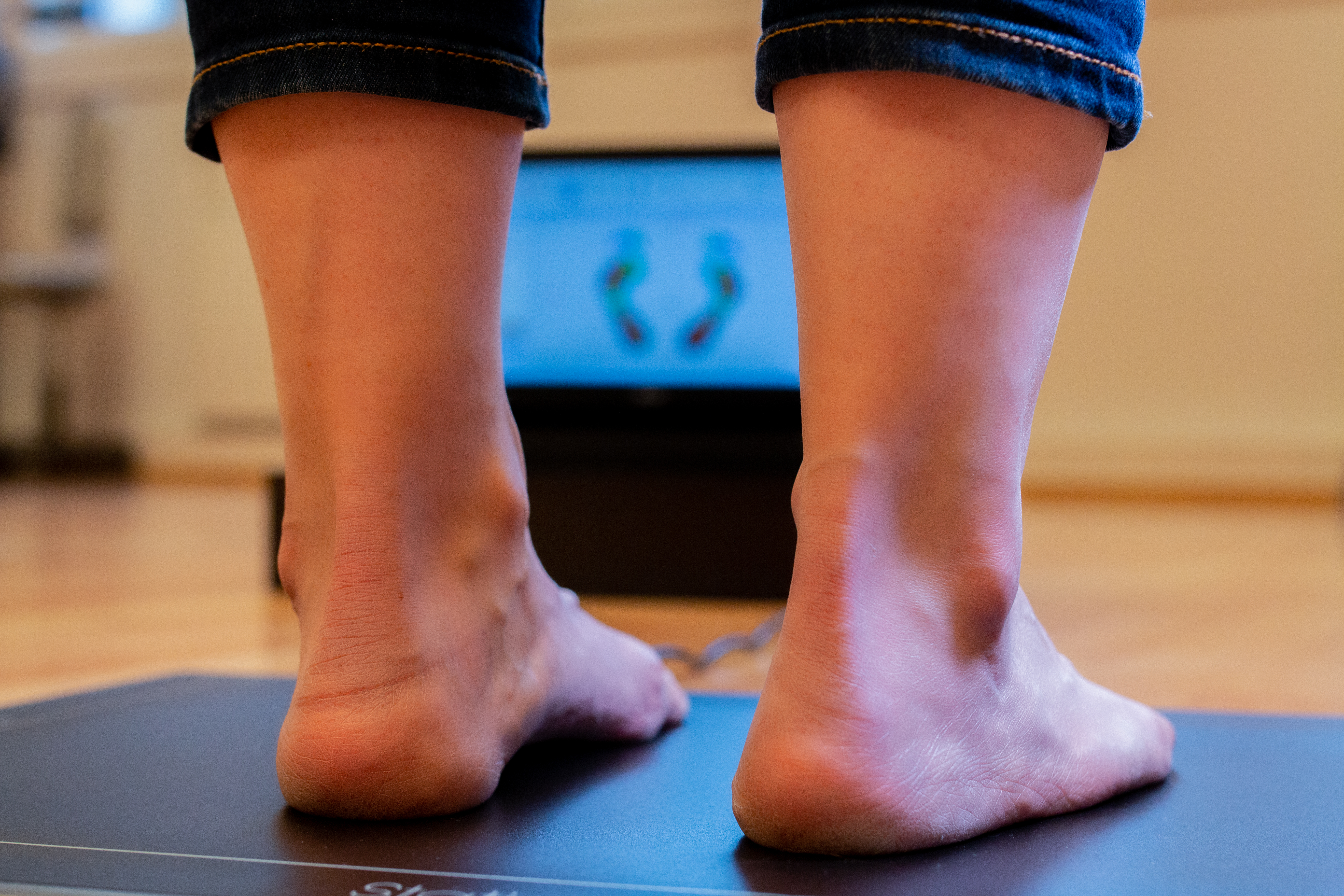 Ganganalyse av fot for såletilpassing.